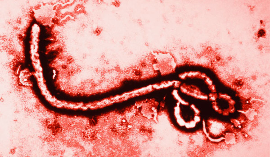 Megjelent az ebola, már halálos áldozata is van 