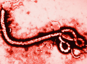 Egyre aggasztóbb az ebola-helyzet Ugandában