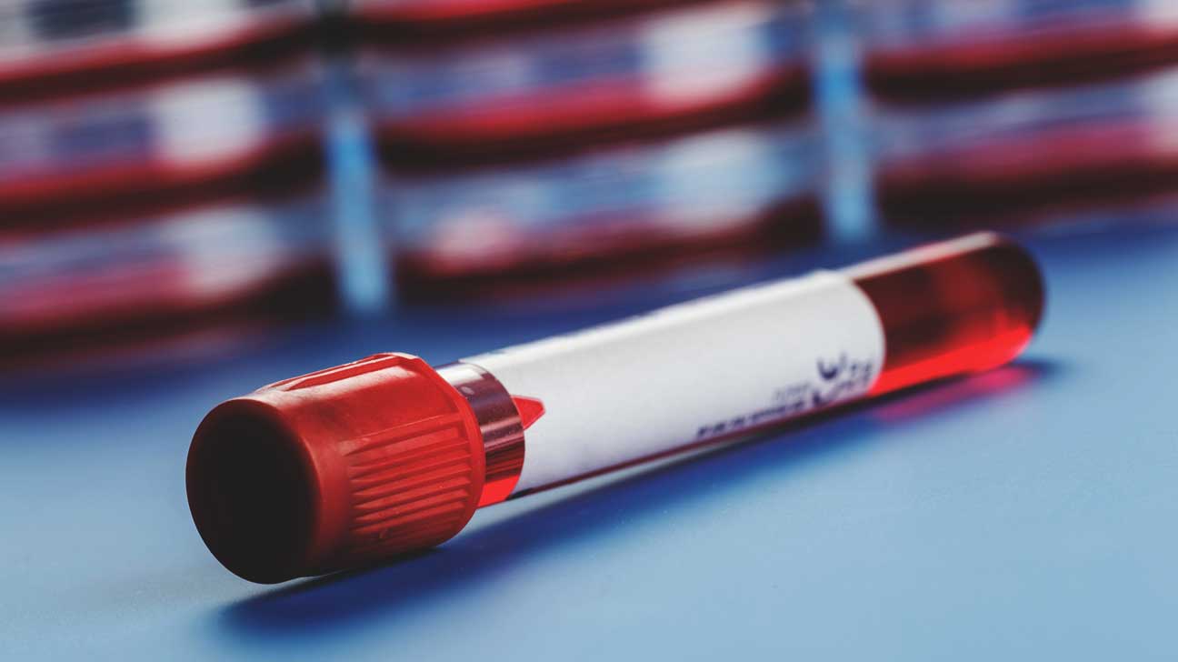Kit veszélyeztet a koronavírus? Újabb megoldás született a kimutatására