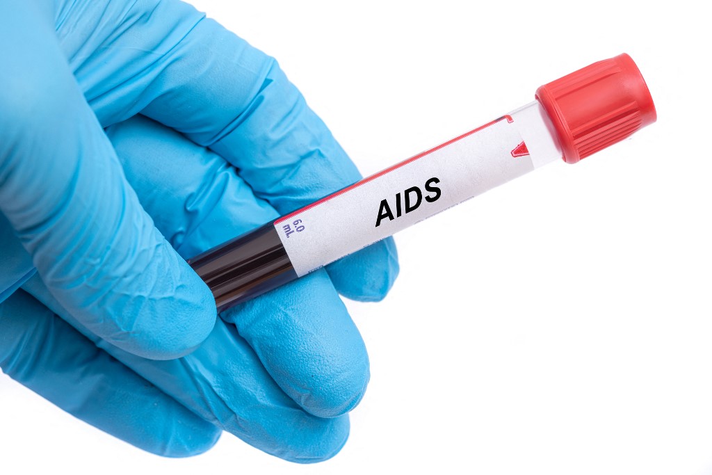 Közelebb a gyógymód: sikeresen távolították el a HIV-vírust a sejtekből
