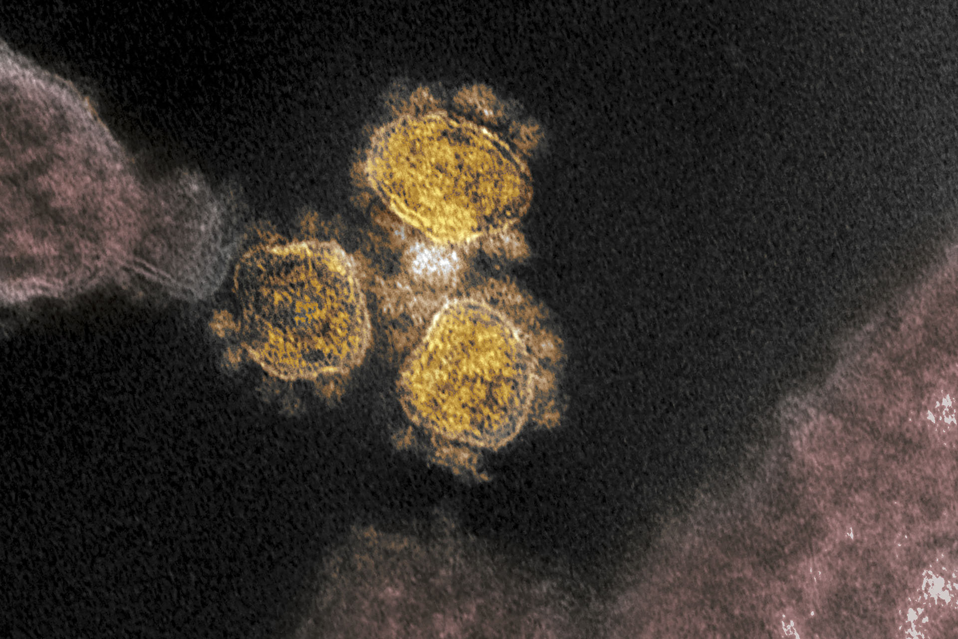 Kínai tudósok 2015-ben biofegyverként vizsgálták a koronavírusokat