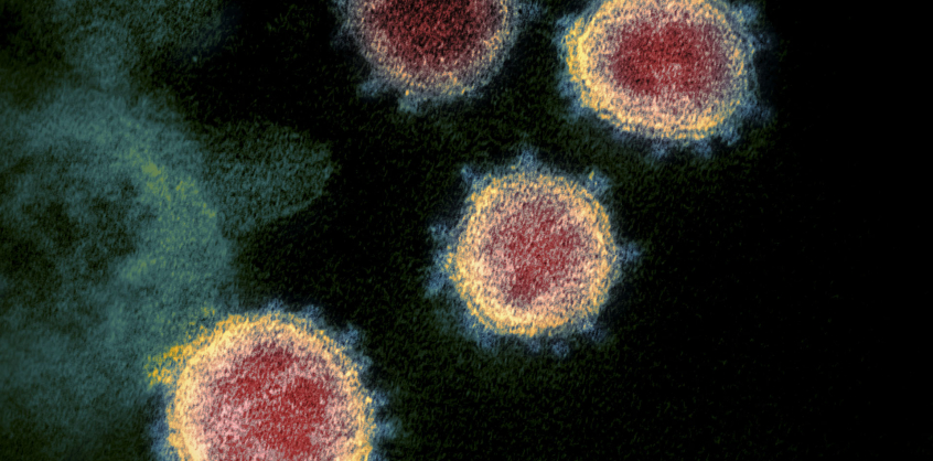 Már közel 6,4 millió koronavírusos halt bele a világon a fertőzésbe