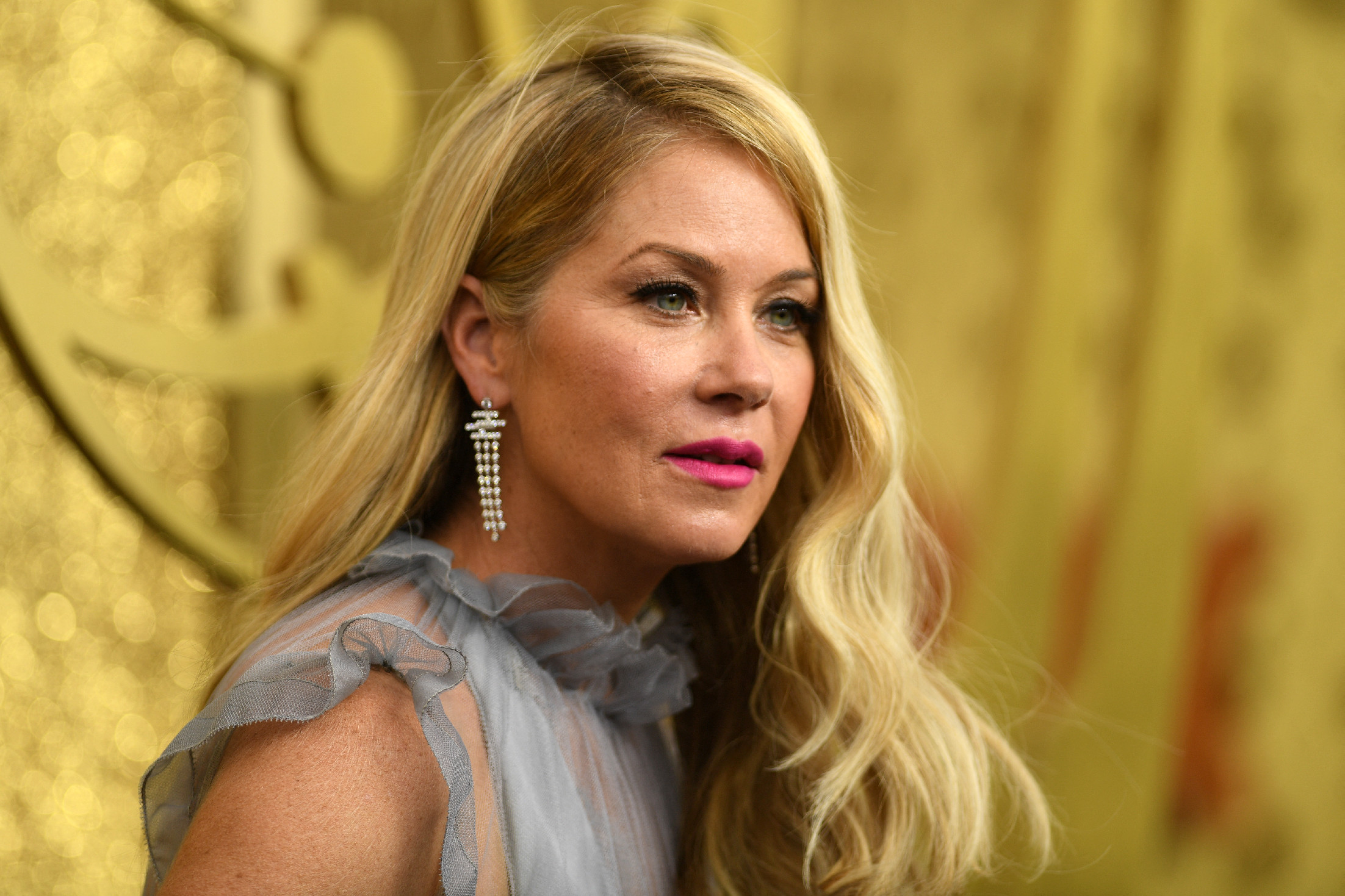 Fotó: Tolószékbe kényszerült Christina Applegate