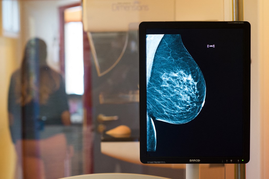 Hónapok óta nincs mammográfiás szűrés az Uzsokiban