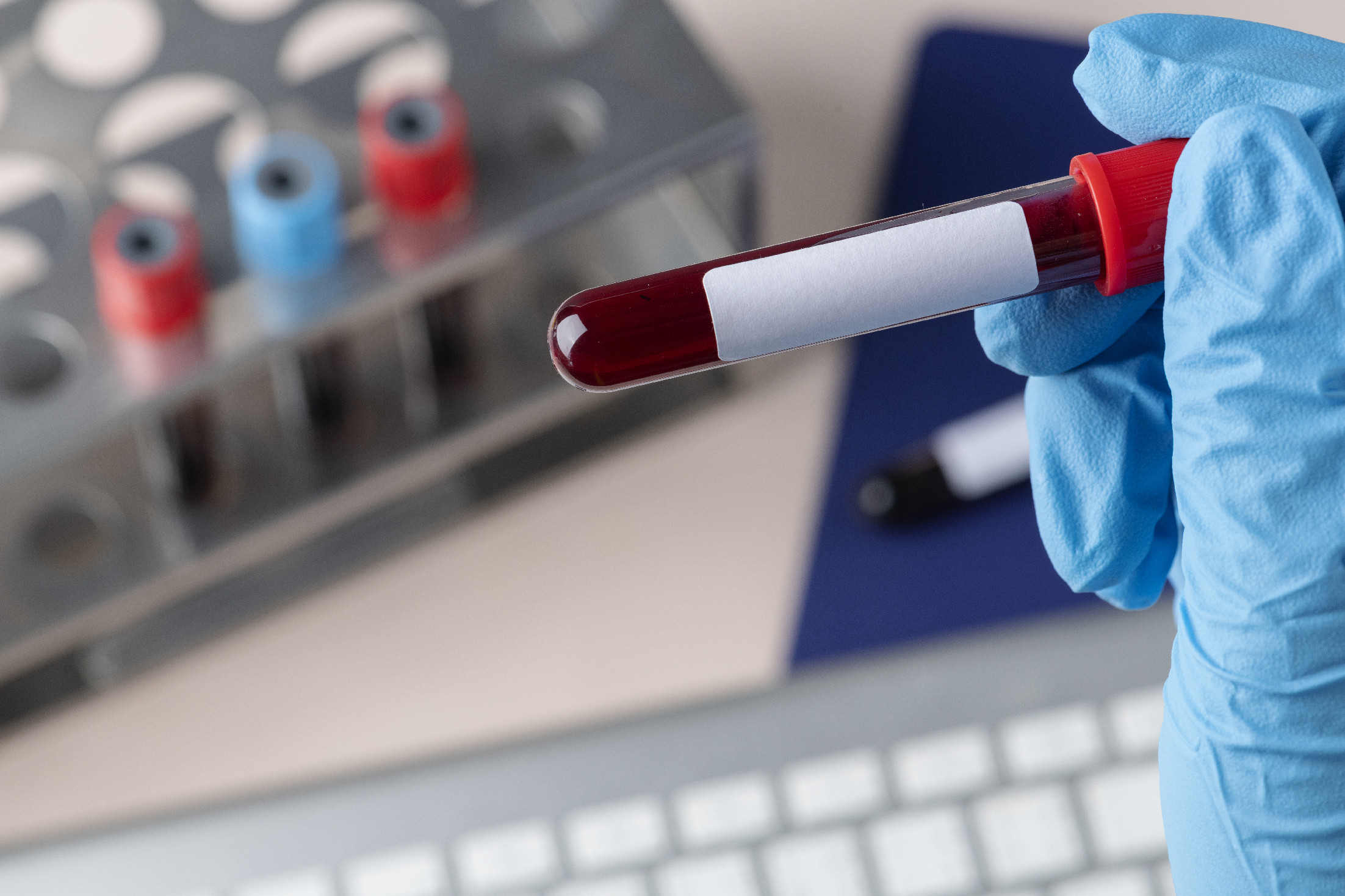 Új DNS-alapú vérvizsgálat segít a rák korai felismerésében